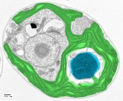 The algal pyrenoid could be the key to increasing crop yields. A pyrenoid (blue) is seen in a cross-section of an algal cell by false-colored electron microscopy. The pyrenoid sits inside the chloroplast (green), which harvests light energy to drive carbon fixation.