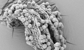 Arabidopsis flower, anther with pollen grains