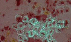 Tobacco root meristem divisions stained with orcein