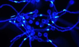 Arabidopsis pollen germination stained with aniline blue.