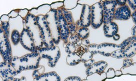 Tobacco leaf, cross section, stained with toluidine blue and lugol