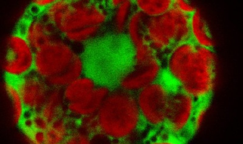 Tobacco protoplast cells expressing GFP-fused protein. Chloroplasts appear red due to the autofluorescence of chlorophyll.