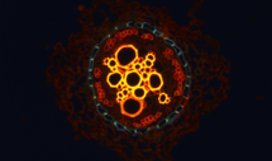 Medicago truncatula root , vibratome cross section, stained with acid orange