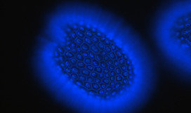 Arabidopsis seed stained with calcofluor