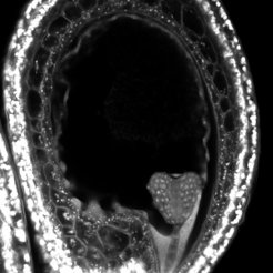 An Arabidopsis seed showing the embryo at “heart” stage. The black region surrounding the embryo is the central vacuole of the endosperm.