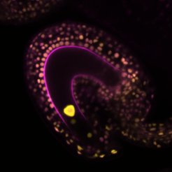 Ovule of Arabidopsis showing an auxin biosensor, as imaged by confocal microscopy.