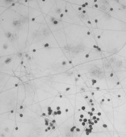 A network of fungal filaments (hyphae) with fungal spores on culture medium.